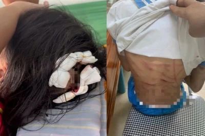 Dấu hiệu các tội danh vụ cha dượng bạo hành bé gái bằng búa đinh ở Hà Tĩnh