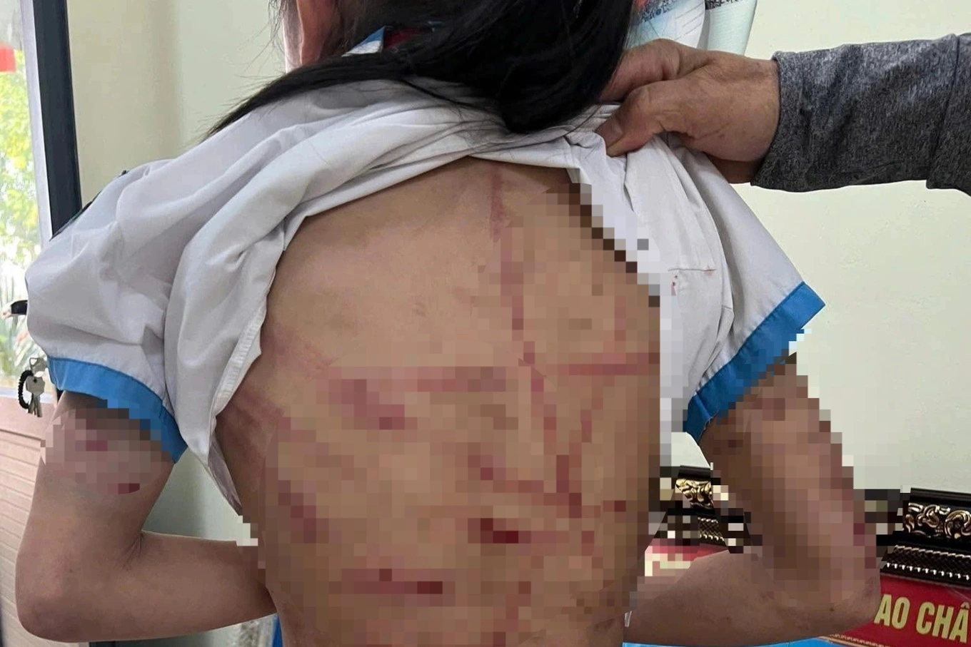 dau hieu cac toi danh vu cha duong bao hanh be gai bang bua dinh o ha tinh 1761098863480